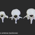 Various human vertebrae (backbones)