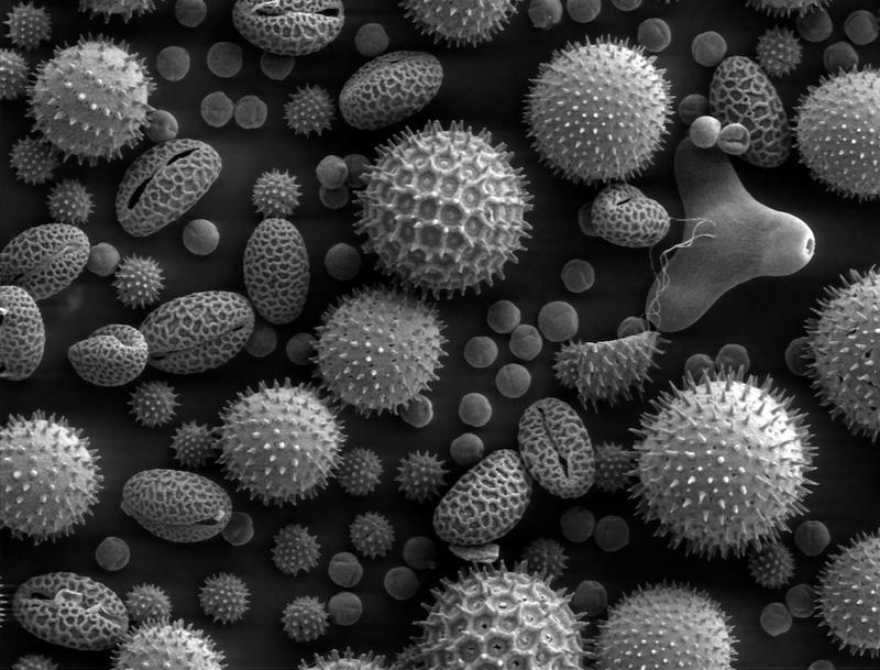 An image of pollen taken by a scanning electron microscope